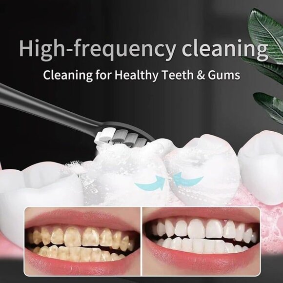 Electric Toothbrush Set with 10 Brush Heads and Travel case - Picture 5 of 7